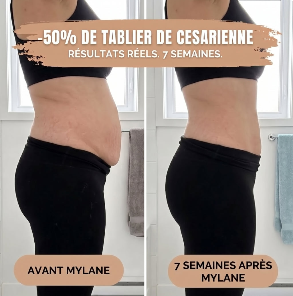 Culotte Post-Partum Compression 360